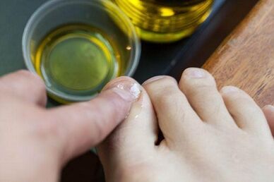 Treatment of fungi