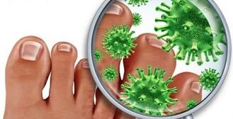 How to treat a fungus infection on the fingers