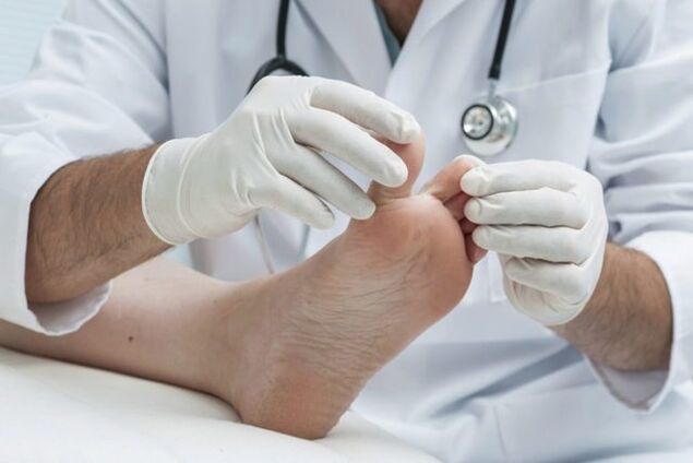 diagnosis of foot fungus by a doctor