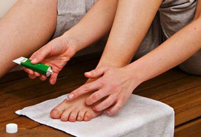 application of ointment to treat toenail fungus